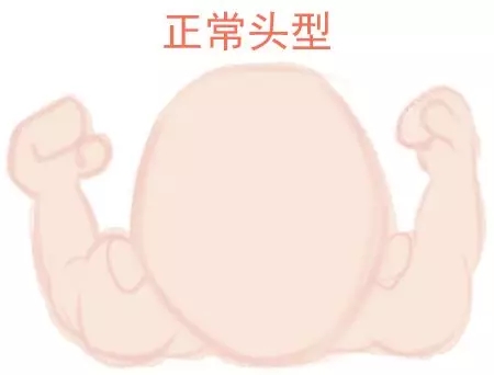 ԲͷվɱͷЩ趼֪1.webp.jpg