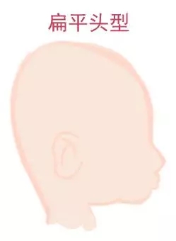 ԲͷվɱͷЩ趼֪4.webp.jpg